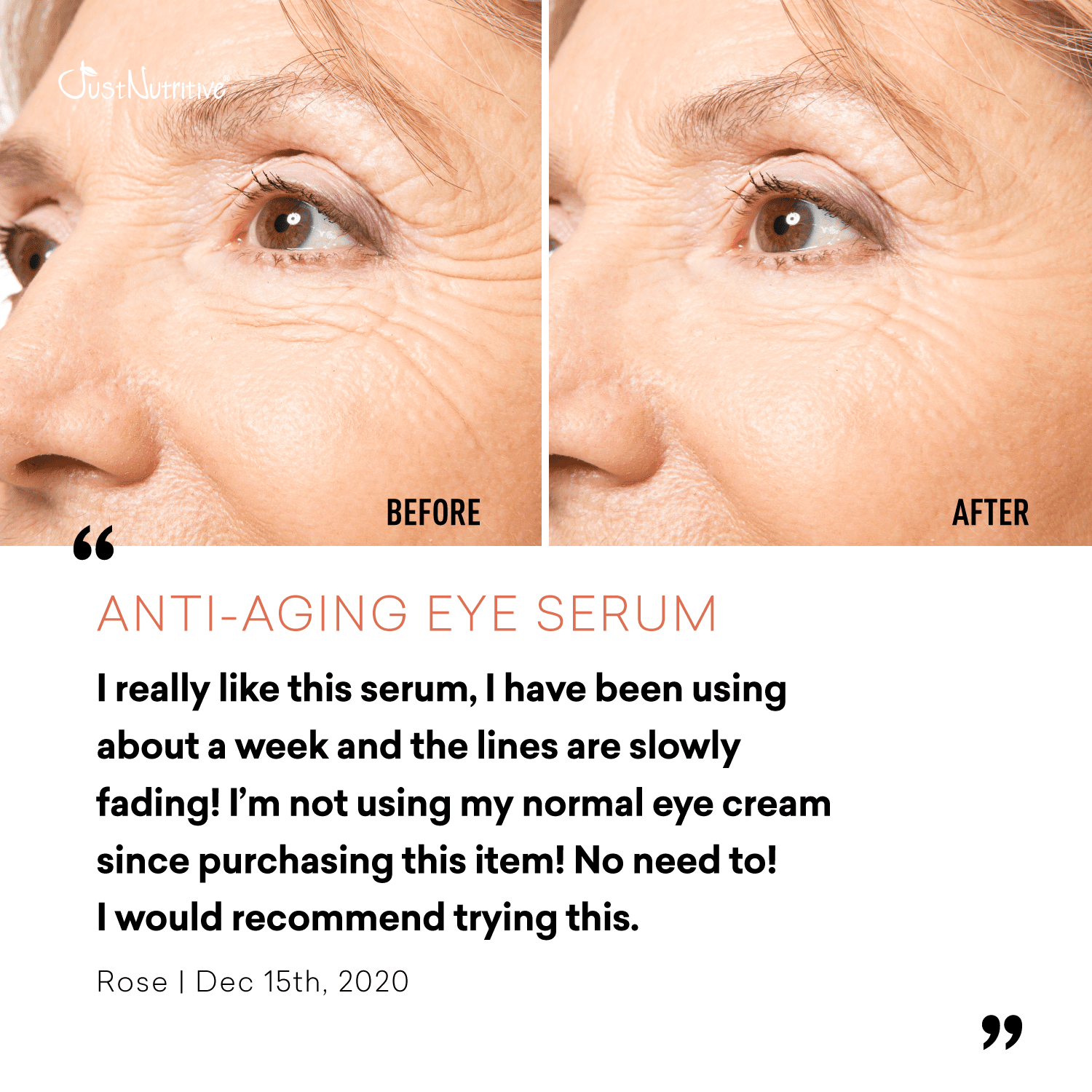 Just Nutritive Anti-Aging Eye Serum for Puffy Eyes, Wrinkles & Dark Circles, Naturally Derived, 1oz
