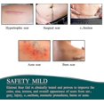 thumbnail image 3 of Silicone Plasters For Scars, Silicone Scar Films For Surgeries, Caesarean Section, Keloids, Burns,silicone Scar Tape-4cm*3m, 3 of 5
