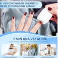thumbnail image 2 of Láser Para Tratamiento Remedio Hongos Unas Onicomicosis Modelo Blanco, 2 of 4
