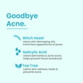 thumbnail image 6 of Acne Clarifying Face Toner for Teens by Natural Outcome Skin Care - Salicylic Acid Facial Astringent to Clear Acne & Purify Pores - Fragrance Free, Alcohol Free 6.7 oz, 6 of 8