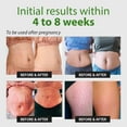 thumbnail image 5 of Abera Ovela Stretch Mark Cream for Pregnancy, Postpartum & Weight Fluctuations, Sunflower Jojoba Oil, 1.69fl oz, 5 of 9