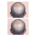 thumbnail image 2 of PRÁTICA DE PIMINACIÓN DEL CUERO CABELDO PIEL, Silicona 2pcs Prepint -Hombre Calvo Micropigmentation Práctica de la Piel para la Piel para la Práctica del Cuero Cabelludo, 2 of 7