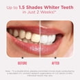 thumbnail image 4 of GuruNanda Sensitive Teeth Whitening Strips, Gentle on Teeth, Clinically Tested, 7-Day Treatment, 4 of 13
