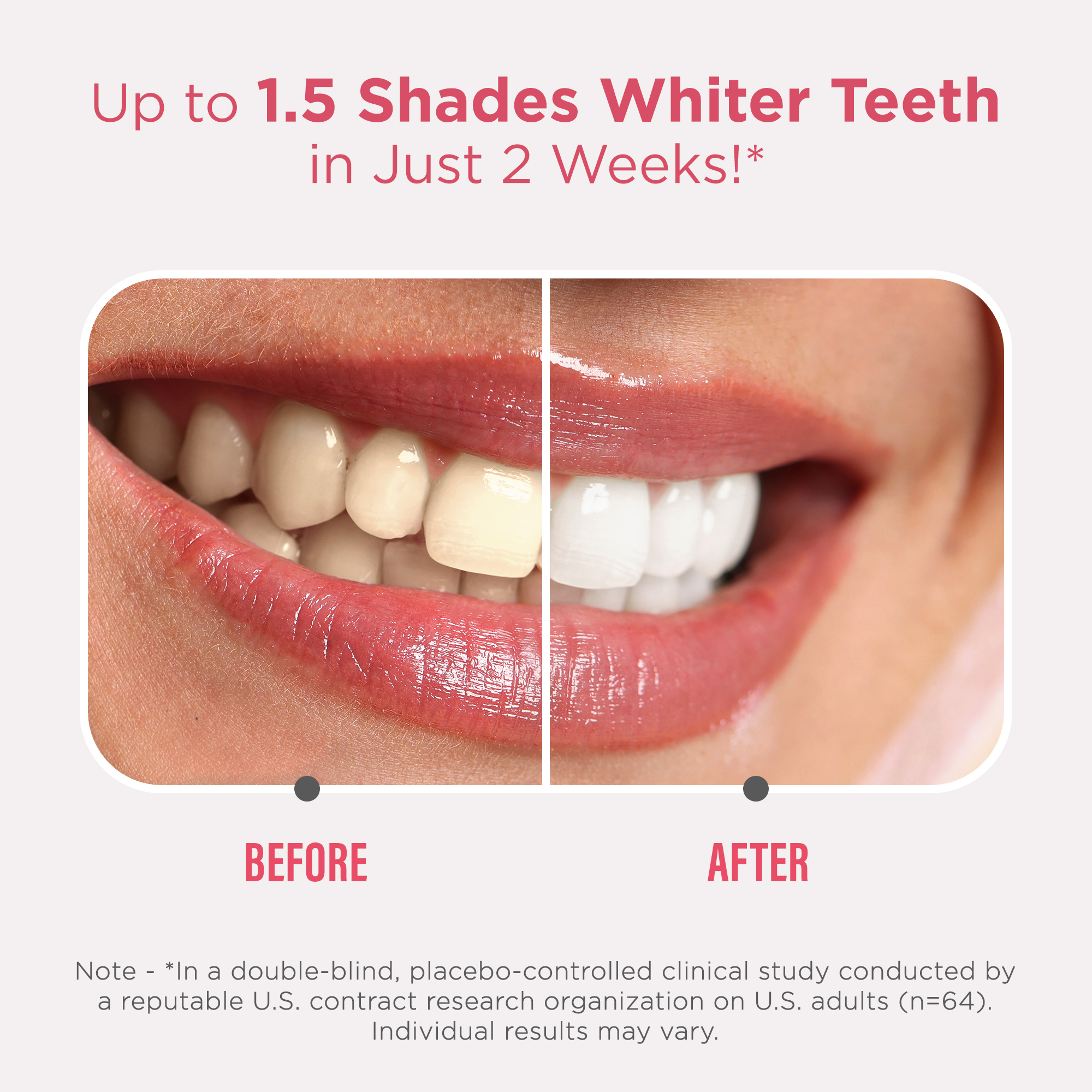 GuruNanda Sensitive Teeth Whitening Strips photo 3