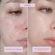thumbnail image 2 of Serum Tower 28 SOS Intensive Rescue para pieles sensibles, 60 ml, 2 of 9