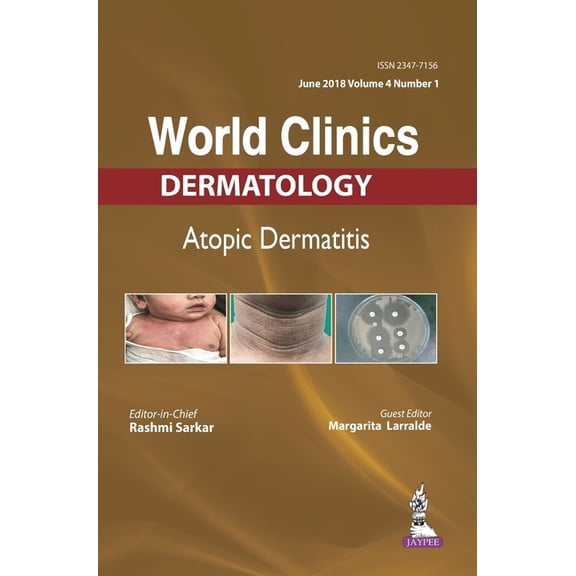 World Clinics-Atopic Dermatitis (June 2018, Vol.04 Issue 1), (Hardcover)