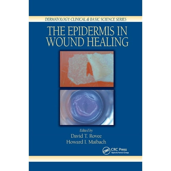 The Epidermis in Wound Healing, (Paperback)