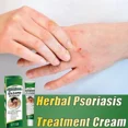 thumbnail image 4 of Crema de hongos para la piel saludable más efectiva, pomada de hierbas naturales, crema antibacteriana para tratar la psoriasis, dermatitis, eczema, 4 of 5