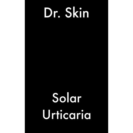 Solar Urticaria - eBook (Best Treatment For Urticaria)