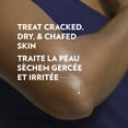 thumbnail image 4 of Vaseline Gelée Réparatrice Originale Retient l'Hydratation et Protège la Peau Sèche, 192 g, 4 of 9