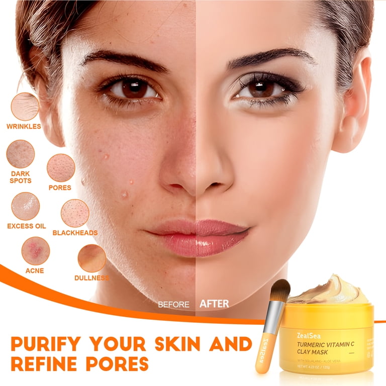 ZealSea, Turmeric Clay Mask, Vitamin C, 4.23 oz, Yellow - Walmart.com
