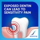 thumbnail image 2 of Pasta dental Sensodyne Extra Whitening para dientes sensibles 2x77 ml, 2 of 7