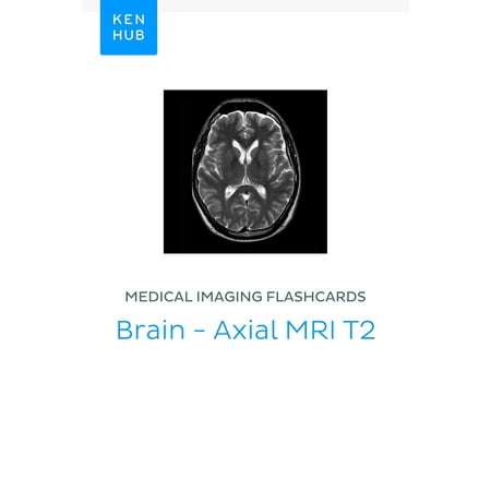 Medical Imaging flashcards: Brain - Axial MRI T2 -