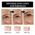 thumbnail image 5 of QunYou Wrinkle Reducing Eye Cream Repair Eye Cream Firming and Fading Fine Lines Moisturizing Skin Hydrating Eye Cream Removing Eye Bags Eye Care 30g, 5 of 9