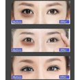 thumbnail image 4 of Eye protection instrument fade dark circles eye bags stay up late artifact dry fatigue massage eye mask, 4 of 4