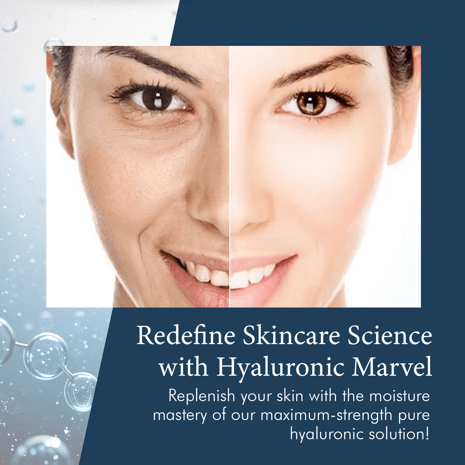 Delfogo Rx 100% Pure Hyaluronic Acid Cream for Face - Deep Hydration Moisturizer for Dry Skin, Anti Aging Facial, Plumping Day & Night Cream for Women and Men