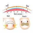 thumbnail image 3 of EGNMCR Finger Toe Incorporated Orthodontic Toe Thumb Patch Roll Fast Toe Pedicure toe care, 3 of 9
