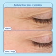 thumbnail image 2 of Crema para ojos Skinfix Barrier+ Triple Lipid-Boost 360° 15ml, 2 of 6