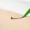 thumbnail image 4 of Gohope Tick Removal Tool for Dogs, Cats and Humans | Ultra-Safe Tick Remover | Pain-Free Ticks Remover, 4 of 8