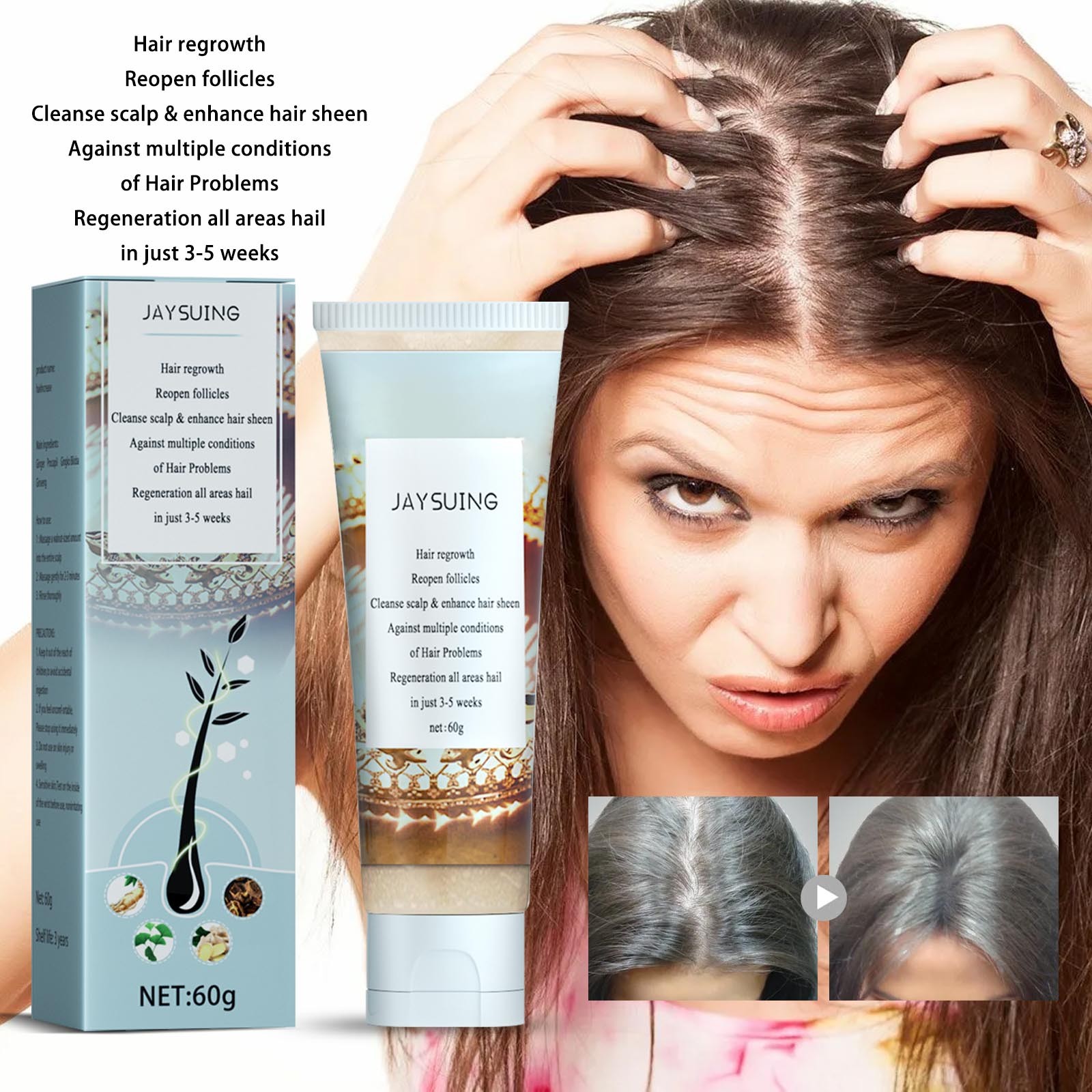 Ktyne Herbal Hair Growth Scalp Scrub Helps Regenerate And Moisturize