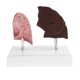 thumbnail image 4 of Modelo de Anatomía Comparación de Pulmón y Patológico Equipo de Laboratorio Juguete de Ciencia, 4 of 9