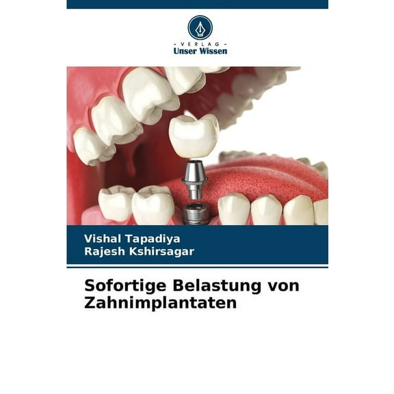 Sofortige Belastung von Zahnimplantaten, (Paperback)