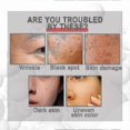 thumbnail image 5 of 2023 New Collagen Boost Anti-aging Serum, Collagen Boost Serum, Collagen Boost Cream, Anti Aging Serum For Women, C, 5 of 5