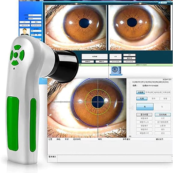 Eye Iridology Camera, Iris Analysis Camera, 12MP High Resolution USB Iris Analysis Camera with Single Dual Lamp Control Adjustable Focus Win7, Win8, Win10, Win11, for Beauty Salons