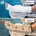 thumbnail image 7 of COEQINE Floral 2 Pack Leg Cast Covers Below The Knee Leg Cast Sleeve Breathable Cast and Bandage Protector-S Easy to Clean Wound Care Supplies Decoration Cover for Women Men Seniors, 7 of 7