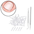 thumbnail image 4 of 50 Pieces Ingrown Toenail Corrector Strips Curved Toenail Corrector Toenail Correction Tool Comfortable Toenail Straightener Strip SPA, 4 of 8