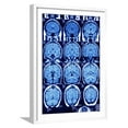 thumbnail image 1 of Brain Scans, MRI Scans, Figurative Framed Art Print Wall Art by PASIEKA Sold by Art.Com, 1 of 6