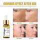 thumbnail image 5 of Collagen Facial Serum Moisturizing Anti-aging Fade Care Lifting Firmi, 5 of 5