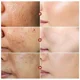thumbnail image 5 of Suero Facial para cuidado de la piel, repara los poros grandes, ácido salicílico, antiarrugas, control de aceite, blanqueamiento., 5 of 5