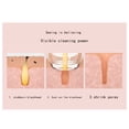 thumbnail image 5 of My Order Naittoop Blackhead Remover Pore Cleaner USB Charging Stand 6 Suction Power Black Suctioner Tools, 5 of 5