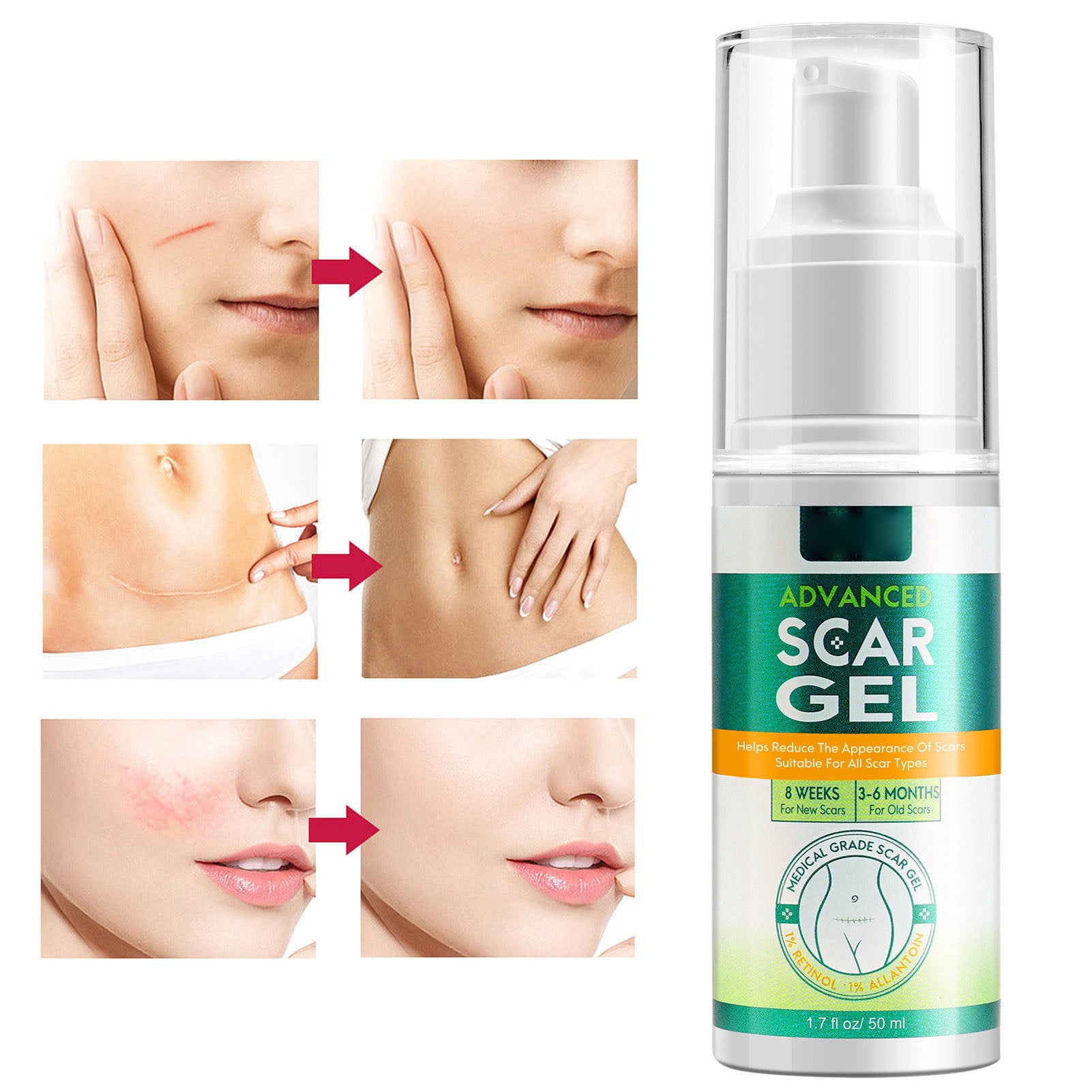 Scar Gel, Fast Increase Skin Rejuvenation 50ml Scars Heal