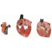 Medical Anatomical Human Jumbo Heart Model, 3-Part, 3X Enlarged