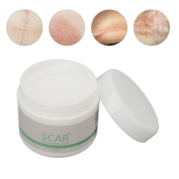 Crema Hidratante Para Cicatrices, Crema Para Eliminar Cicatrices, Sin Irritación, Reduce Las Arrugas, Masaje, Absorbe Para Cicatrices Quirúrgicas