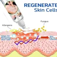 thumbnail image 5 of Ungüento de Psoriasis a base de hierbas naturales, tratamiento de Dermatitis, Eczema, crema antibacteriana, cuidado antiprurítico DE LA PIEL, 5 of 5