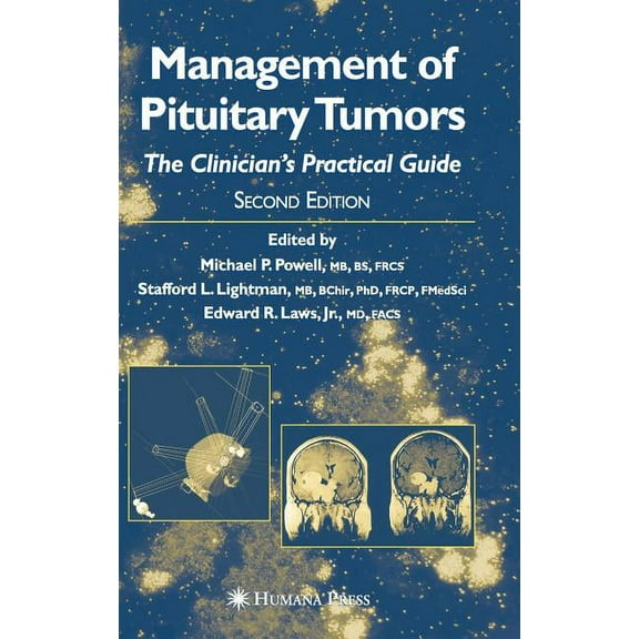 Management of Pituitary Tumors: The Clinician's Practical Guide, (Hardcover)