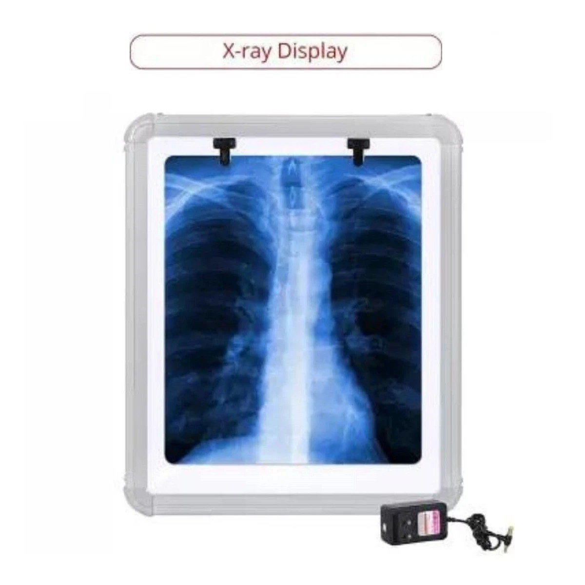 High-Brightness 14'' x 17'' LED X-Ray Viewer – Slim Design with Adjustable Illumination & Energy-Efficient Light Source"