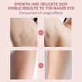 thumbnail image 5 of Facial Hair Removal Epilator, Rechargeable Hair Remover for Face, Painless Women Hair Remover, 5 of 5
