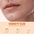 thumbnail image 3 of Pimple Patches for Face, 3 Size 102 Counts Acne Patches, Hydrocolloid Patches for Covering Zits and Blemishes, Spot Stickers for Face and Skin, 3 of 8