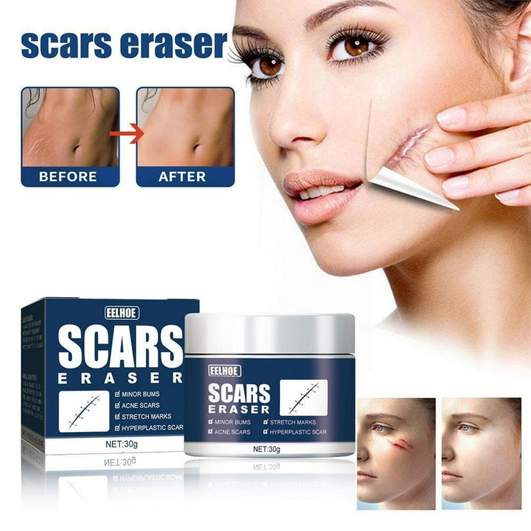 Eraser Burn Scars