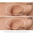 thumbnail image 4 of Almohadillas faciales exfoliantes StriVectin Advanced Resurfacing 60 unidades, 4 of 9