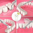 thumbnail image 4 of Professional dental hygiene kit - 4 parts, 4 of 5