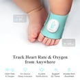 thumbnail image 2 of Monitor de bebé Sense-U Smart Sock Shoe (largo alcance) con indicador de sueño y notificaciones en el dispositivo, seguimiento de frecuencia cardíaca, oxígeno, movimiento desde cualquier lugar para ma, 2 of 5