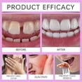 thumbnail image 3 of Adheza Thermoplastic Denture Adhesive, Zinc-Free Formula Long-Lasting Hold Up to 7 Days Secure Fit, 3 of 5
