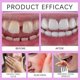 thumbnail image 4 of Adheza Thermoplastic Denture Adhesive, Zinc-Free Formula Long-Lasting Hold Up to 7 Days Secure Fit, 4 of 5