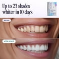 thumbnail image 4 of Tiras blanqueadoras dentales U-Wraps Boca Bella 15% peróxido 10 tratamientos, 4 of 8