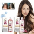 thumbnail image 1 of O Nion, Biotin And R Osemary Shampoo, Todo Tipo De Cabello Acondicionador Cuidado Del Cabello, Cabello Adelgazado, Set De Champú Para El Crecimiento-200ml, 1 of 4